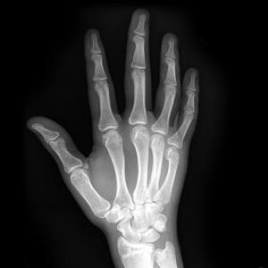 1c45f6edf7bd233f4fbea3c941c712_gallery